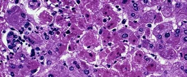 WHO cảnh báo hai dịch bệnh nguy hiểm